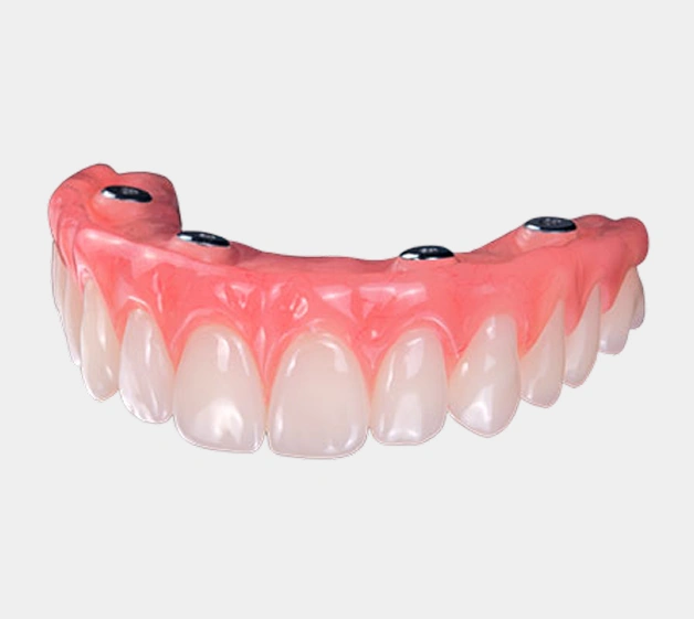 Dental prosthetic model showing upper teeth implants with pink gum tissue on white background.