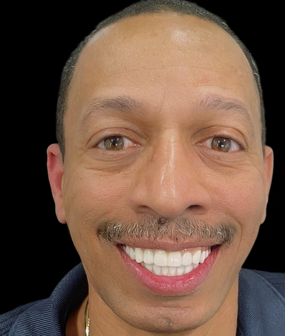 Smiling man with bright teeth against black background for dental practice website