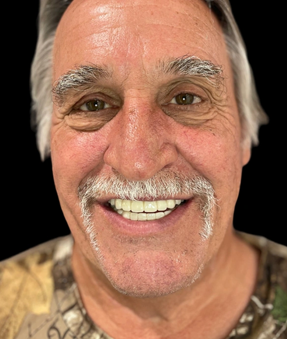Smiling middle-aged man with mustache in casual yellow shirt against black background