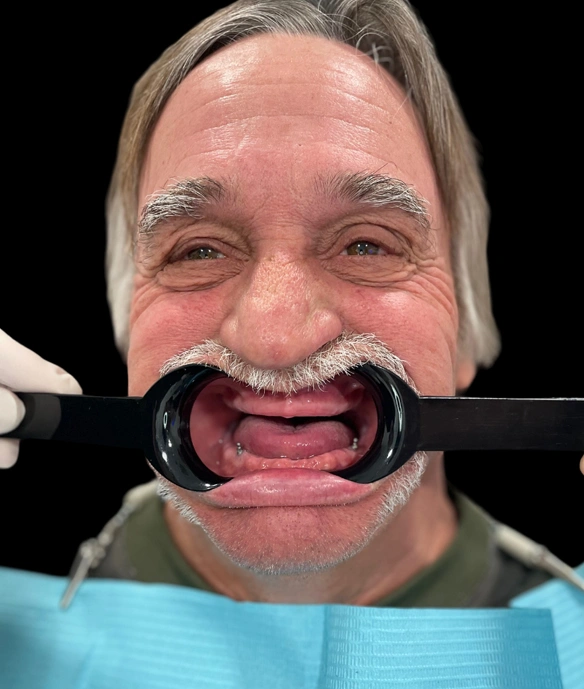 Man demonstrating wide open mouth during dental examination at Hometown Dental office