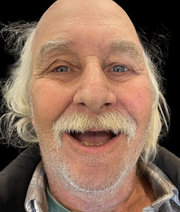 Smiling middle-aged man with gray beard and hair against black background for dental practice.