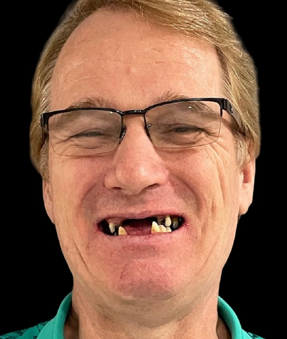 Man with glasses smiling broadly against black background, wearing teal shirt.